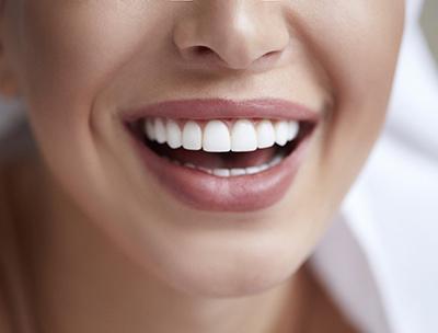 An up-close image of a woman’s whiter, brighter teeth