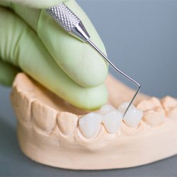 A dentist crafting a dental bridge