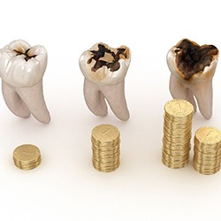 Progressively more decayed teeth next to growing piles of coins