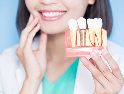 dentist showing a model of a dental implant
