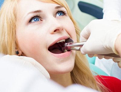 young woman getting a tooth extracted by her dentist