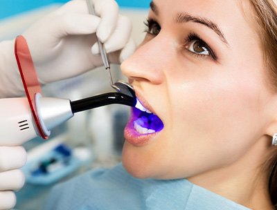 Dentist applying UV light to woman’s dental filling