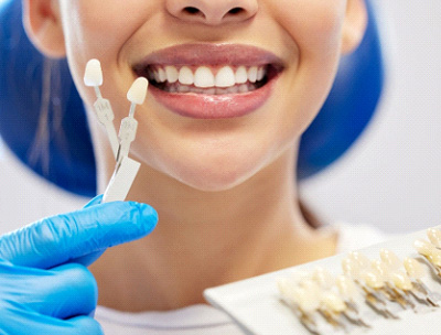 Nose-to-neck view of woman smiling with shade guide held to teeth