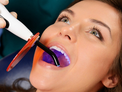 Woman’s tooth-colored filling being bonded with UV light