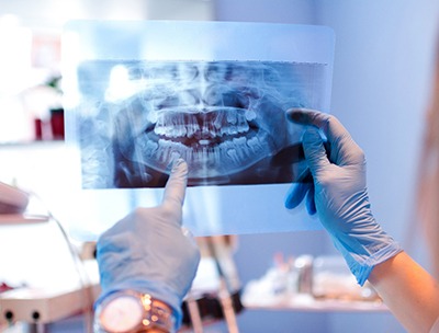 Dentist with blue gloves looking at patient's X-ray