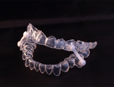 Oral appliance for sleep apnea in Toledo