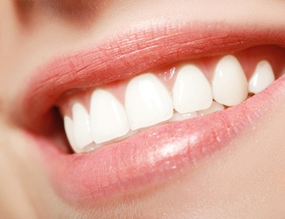 Woman with veneers in Toledo