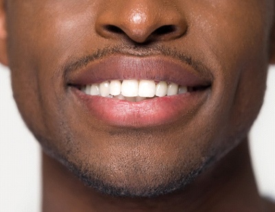 Closeup of beautiful smile thanks to Toledo cosmetic dentist