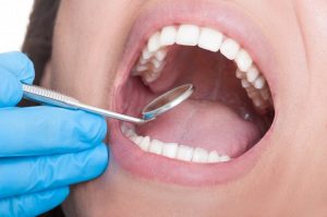 dentista inspecionando a boca do paciente